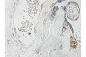 Image no. 1 for anti-Interleukin 15 (IL15) antibody (ABIN464931) (IL-15 Antikörper)