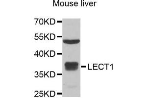 Western blot analysis of extracts of mouse liver, using LECT1 antibody.
