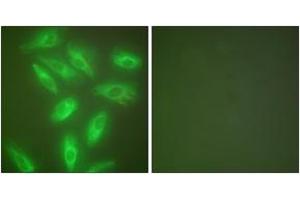Immunofluorescence analysis of HeLa cells, using Keratin 18 Antibody. (Cytokeratin 18 Antikörper  (AA 381-430))
