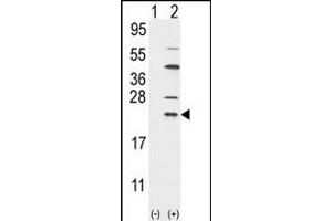 Western blot analysis of UBE2C (arrow) using rabbit polyclonal UBE2C Antibody (N-term G25) (ABIN388856 and ABIN2839158).