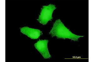 Immunofluorescence of monoclonal antibody to MAP2K5 on HeLa cell. (MAP2K5 Antikörper  (AA 1-120))