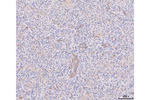 IHC analysis of ANGPT2 using anti-ANGPT2 antibody (ABIN3043725).