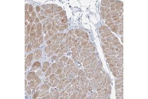 Immunohistochemical staining of human heart muscle with FAM184A polyclonal antibody  shows moderate cytoplasmic positivity in myocytes at 1:200-1:500 dilution. (FAM184A Antikörper)