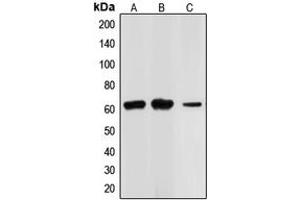 Western blot analysis of CHK2 expression in Jurkat (A), HL60 (B), HT29 (C) whole cell lysates. (CHEK2 Antikörper  (N-Term))