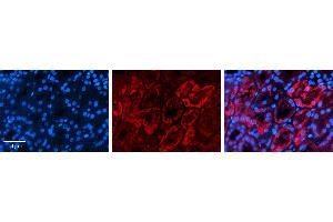 Rabbit Anti-AQP2 Antibody   Formalin Fixed Paraffin Embedded Tissue: Human Kidney Tissue Observed Staining: Cytoplasm Primary Antibody Concentration: 1:100 Other Working Concentrations: 1:600 Secondary Antibody: Donkey anti-Rabbit-Cy3 Secondary Antibody Concentration: 1:200 Magnification: 20X Exposure Time: 0.