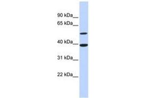 Image no. 1 for anti-Activating Transcription Factor 7 (AFT7) (AA 71-120) antibody (ABIN6744399) (AFT7 Antikörper  (AA 71-120))