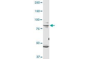 TRPV1 monoclonal antibody (M01), clone 1F5. (TRPV1 Antikörper  (AA 21-124))