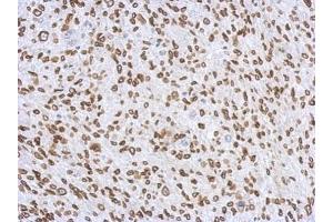 IHC-P Image Immunohistochemical analysis of paraffin-embedded C2C12 xenograft, using Lamin A + C, antibody at 1:500 dilution. (Lamin A/C Antikörper)