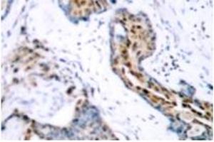 Image no. 2 for anti-Estrogen Receptor 1 (ESR1) (pSer118) antibody (ABIN318018) (Estrogen Receptor alpha Antikörper  (pSer118))