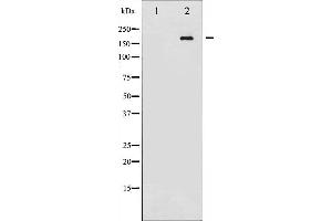 Western blot analysis of Ret phosphorylation expression in K562 whole cell lysates,The lane on the left is treated with the antigen-specific peptide. (Ret Proto-Oncogene Antikörper  (pTyr1062))