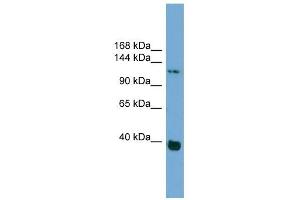 Catenin antibody used at 1 ug/ml to detect target protein. (Catenin Antikörper)