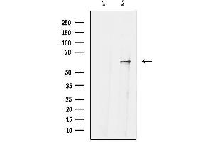 anti-G Protein-Coupled Receptor Kinase 4 (GRK4) (N-Term) antibody