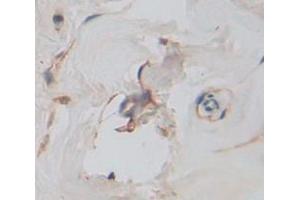 IHC-P analysis of Human Tissue, with DAB staining. (KIR2DL1 Antikörper  (AA 22-348))