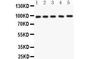 Anti- NUP98 Picoband antibody, Western blotting All lanes: Anti NUP98  at 0. (NUP98 Antikörper  (AA 549-880))