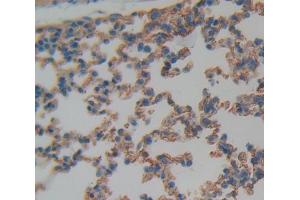 Used in DAB staining on fromalin fixed paraffin- embedded Kidney tissue (CD11c Antikörper  (AA 907-1115))