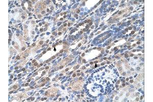 Sample Type: Human KidneyDilution: 4. (NOLC1 Antikörper  (C-Term))