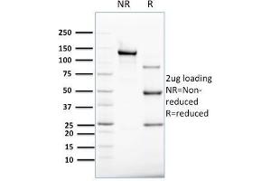 SDS-PAGE (SDS) image for anti-Keratin 8 (KRT8) antibody (ABIN6939880)