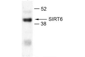 U2OS (SIRT6 Antikörper  (N-Term))