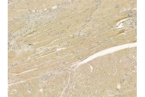 ABIN6265892 and ABIN6276955 at 1/100 staining human tongue carcinoma by IHC-P. (Uromodulin Antikörper  (C-Term))