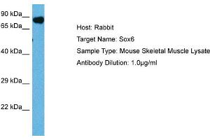 Host: Mouse Target Name: SOX6 Sample Tissue: Mouse Skeletal Muscle Antibody Dilution: 1ug/ml (SOX6 Antikörper  (Middle Region))