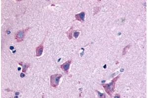 Anti-QRFPR / GPR103 antibody  ABIN1049284 IHC staining of human brain, neurons and glia. (QRFPR Antikörper  (N-Term))