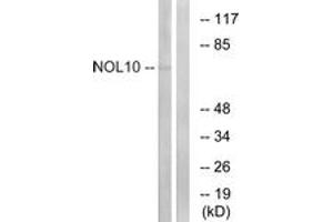 Western blot analysis of extracts from HuvEc cells, using NOL10 Antibody.