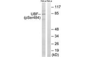 Western blot analysis of extracts from HeLa cells treated with calyculinA 50ng/ml 30', using UBF (Phospho-Ser484) Antibody. (UBTF Antikörper  (pSer484))