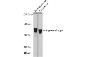 Western blot analysis of extracts of various cell lines, using Angiotensinogen Rabbit mAb (ABIN7265598) at 1:1000 dilution. (AGT Antikörper)
