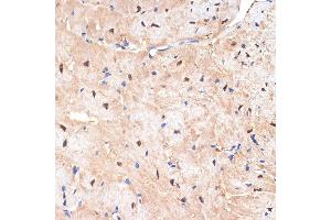 Immunohistochemistry of paraffin-embedded mouse heart using sestrin 1 Rabbit mAb (ABIN7270259) at dilution of 1:100 (40x lens).