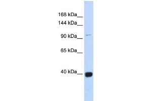 WB Suggested Anti-VAV1 Antibody Titration:  0.