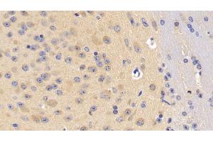 Detection of DLG4 in Mouse Cerebrum Tissue using Polyclonal Antibody to Discs, Large Homolog 4 (DLG4) (DLG4 Antikörper  (AA 1-393))