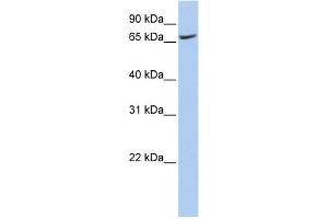 Western Blotting (WB) image for anti-ATPase, H+ Transporting, Lysosomal V0 Subunit A1 (ATP6V0A1) (N-Term) antibody (ABIN2782670)