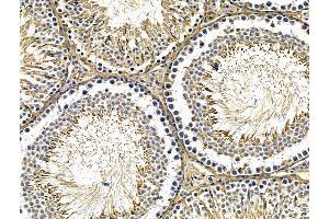 ABIN7096713 and ABIN7100778 at 1/100 staining rat testis tissue by IHC-P. (CHRNE Antikörper)