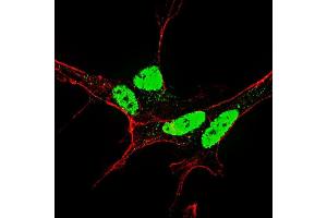 Fluorescent confocal image of SY5Y cells stained with (ABIN390032 and ABIN2839782) Phospho-Nanog-S71 antibody.