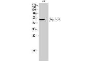 Western Blotting (WB) image for anti-Septin 6 (SEPT6) (Internal Region) antibody (ABIN3177370) (Septin 6 Antikörper  (Internal Region))