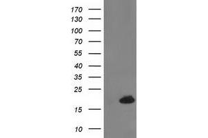 Western Blotting (WB) image for anti-Destrin (Actin Depolymerizing Factor) (DSTN) antibody (ABIN1497910) (Destrin Antikörper)