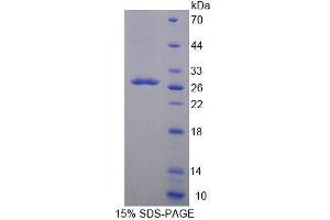 SDS-PAGE analysis of Human ACADL Protein.