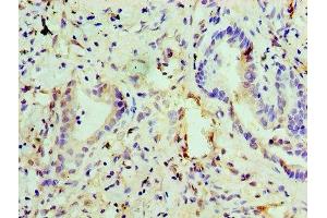 Immunohistochemistry of paraffin-embedded human lung tissue using ABIN7151444 at dilution of 1:100 (PHD1 Antikörper  (AA 283-407))