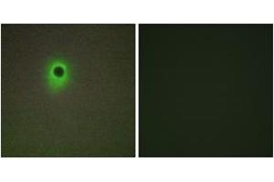 Immunofluorescence (IF) image for anti-Homeodomain Interacting Protein Kinase 4 (HIPK4) (AA 511-560) antibody (ABIN2889676) (HIPK4 Antikörper  (AA 511-560))