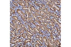 IHC analysis of CBR1 using anti-CBR1 antibody (ABIN7600015). (CBR1 Antikörper  (AA 14-262))