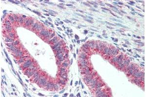 Anti-TM9SF1 antibody  ABIN1104705 IHC staining of human uterus. (TM9SF1 Antikörper  (Internal Region))