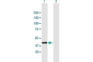 Western Blot analysis of CNP expression in transfected 293T cell line by CNP MaxPab polyclonal antibody. (Cnpase Antikörper  (AA 1-421))