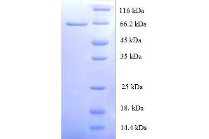 SDS-PAGE (SDS) image for Origin Recognition Complex, Subunit 4 (ORC4) (AA 1-436), (full length) protein (His-SUMO Tag) (ABIN5710049) (ORC4 Protein (AA 1-436, full length) (His-SUMO Tag))