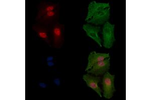 ABIN7094385 and ABIN7098432 staining  cells by IF/ICC. (NDOR1 Antikörper  (N-Term))
