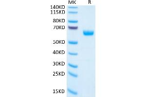 Human PGF on Tris-Bis PAGE under reduced condition. (PLGF Protein (AA 19-221) (Fc Tag))