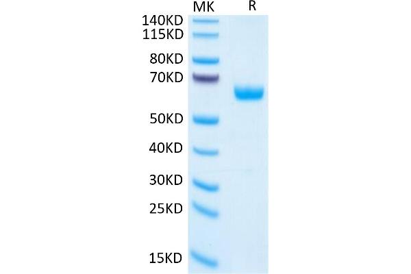 PLGF Protein (AA 19-221) (Fc Tag)