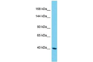 Western Blotting (WB) image for anti-Sterile alpha Motif Domain Containing 9-Like (SAMD9L) (N-Term) antibody (ABIN2790581) (SAMD9L Antikörper  (N-Term))
