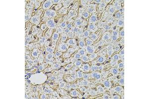 Immunohistochemistry of paraffin-embedded mouse liver using PCSK9 antibody. (PCSK9 Antikörper)