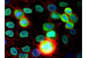 Immunofluorescence staining (human cervix carcinoma cells) Immunofluorescence staining of HeLa human cervix carcinoma cell line using purified anti-Ku Antigen (MEM-54) (detection by Goat anti-mouse IgG2a Alexa Fluor ® 488; green). (X-Ray Repair Cross Complementing 5 Antikörper)