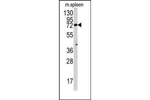 Image no. 1 for anti-Mannosyl (Beta-1,4-)-Glycoprotein beta-1,4-N-Acetylglucosaminyltransferase (MGAT3) (N-Term) antibody (ABIN357703)